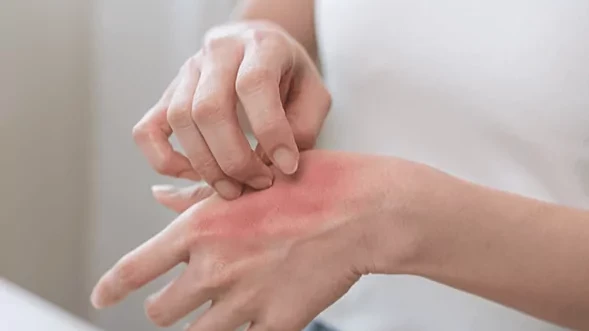 Kaşıntı sadece cilt sorunu değil: Psikolojik nedenler